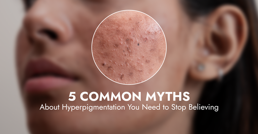 5 Common Myths About Hyperpigmentation You Need to Stop Believing