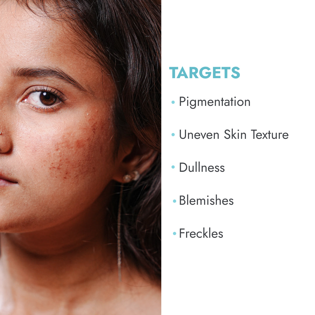 Hyperpigmentation Treatment Kit