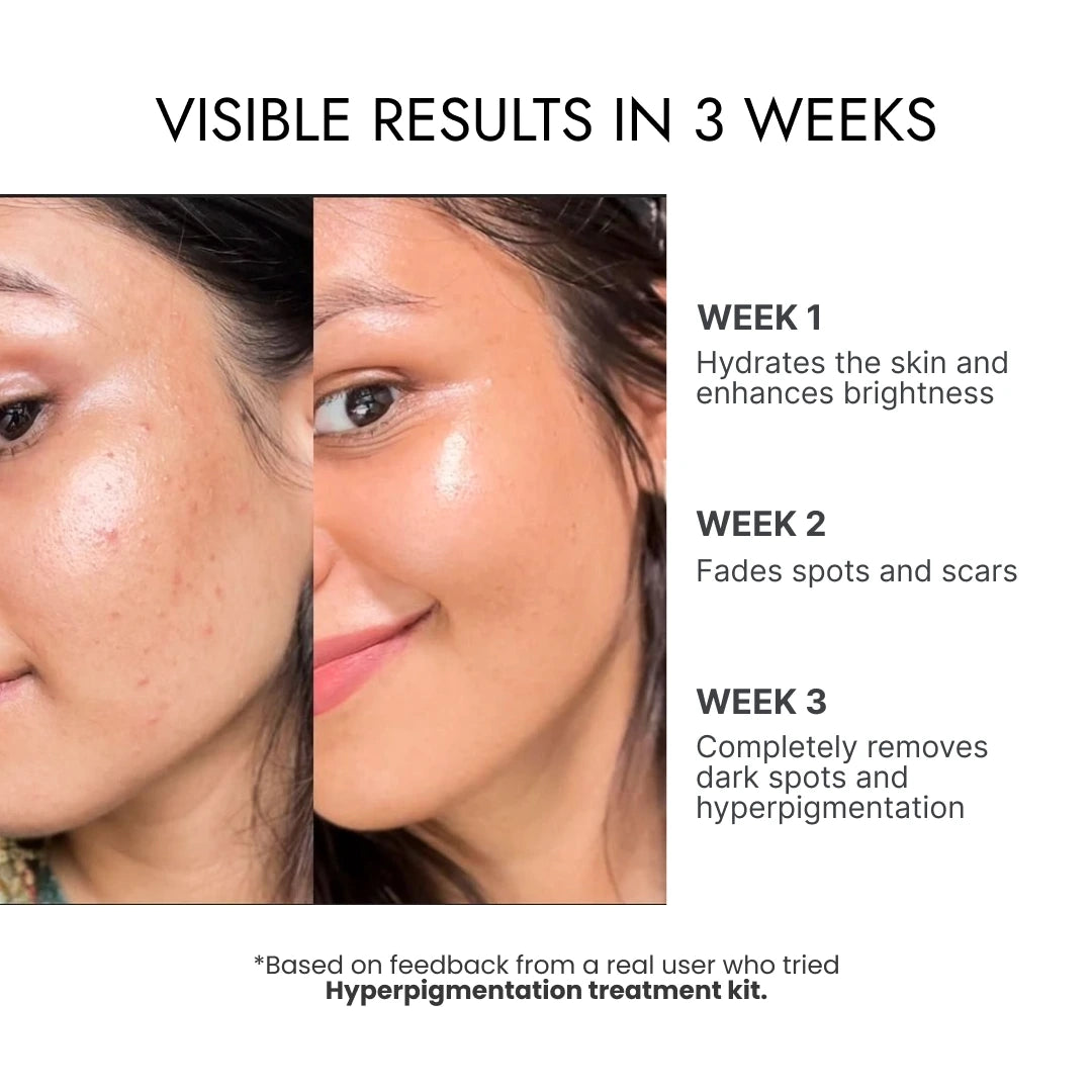 Hyperpigmentation Treatment Kit