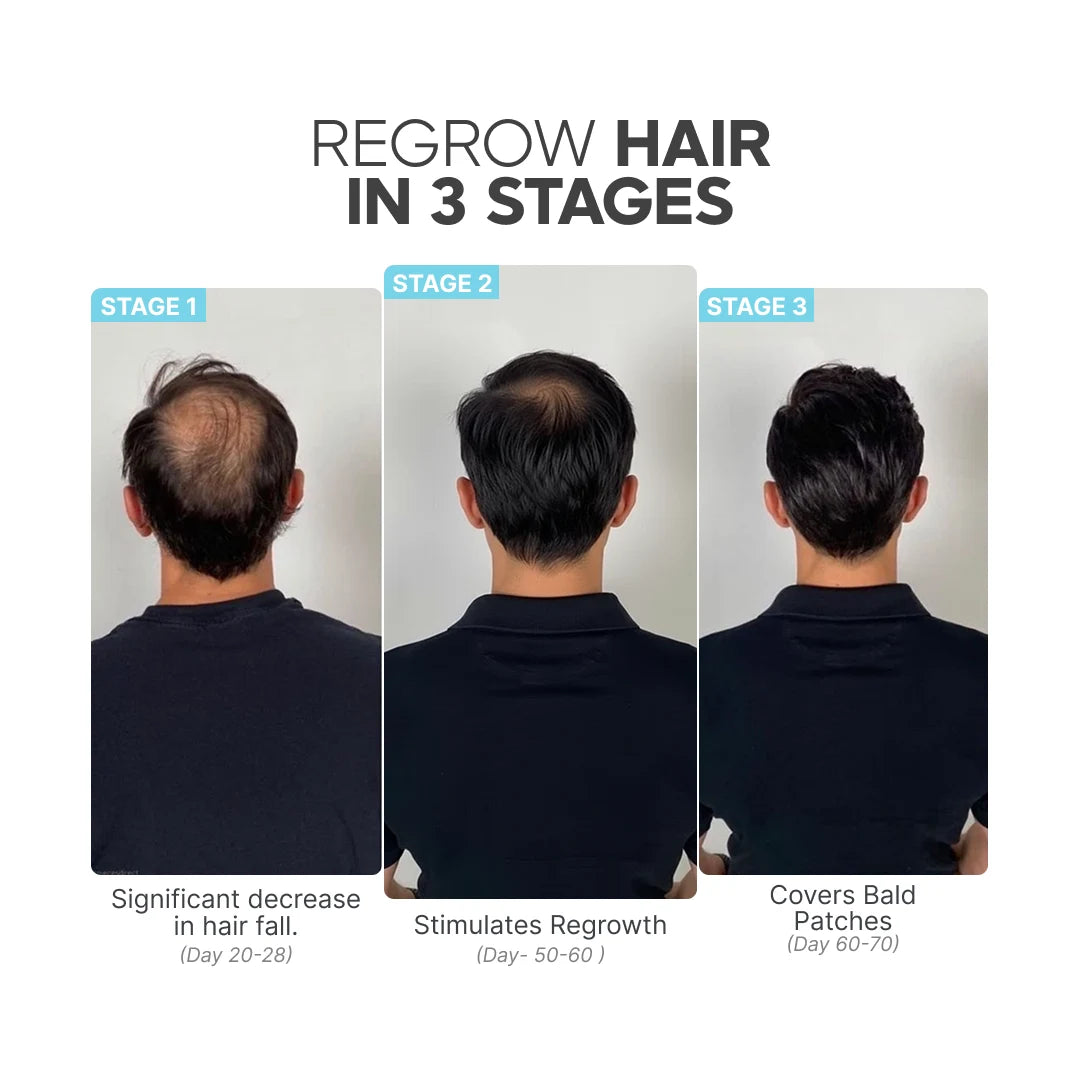 Hair Regrow Kit